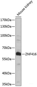 Western blot analysis of extracts of Mouse kidney using ZNF416 Polyclonal Antibody at dilution of 1:1000.