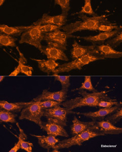 Immunofluorescence analysis of C6 cells using UBQLNL Polyclonal Antibody at dilution of 1:100. Blue: DAPI for nuclear staining.