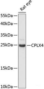 Western blot analysis of extracts of Rat eye using CPLX4 Polyclonal Antibody at dilution of 1:3000.