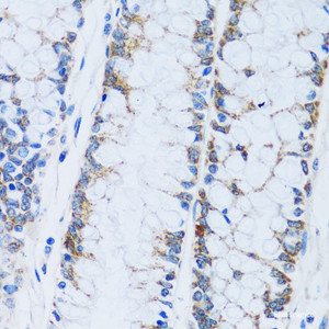 Immunohistochemistry of paraffin-embedded Human colon using CA13 Polyclonal Antibody at dilution of 1:100 (40x lens) .