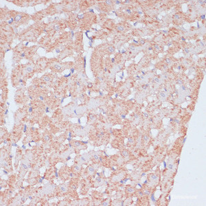 Immunohistochemistry of paraffin-embedded Rat heart using MZB1 Polyclonal Antibody at dilution of 1:100 (40x lens) .