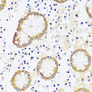 Immunohistochemistry of paraffin-embedded Human stomach using CAMK1 Polyclonal Antibody at dilution of 1:100 (40x lens) .