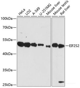 Western blot analysis of extracts of various cell lines using EIF2S2 Polyclonal Antibody at dilution of 1:3000.