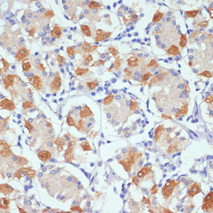 Immunohistochemistry of paraffin-embedded Human stomach using AHR Polyclonal Antibody at dilution of 1:100 (40x lens) .