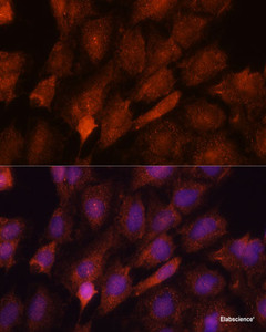 Immunofluorescence analysis of C6 cells using SMYD3 Polyclonal Antibody at dilution of 1:100. Blue: DAPI for nuclear staining.