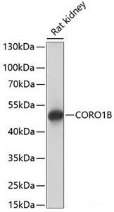 Western blot analysis of extracts of Rat kidney using CORO1B Polyclonal Antibody at dilution of 1:1000.