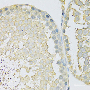 Immunohistochemistry of paraffin-embedded Rat testis using SLC2A9 Polyclonal Antibody at dilution of 1:100 (40x lens) .