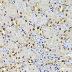 Immunohistochemistry of paraffin-embedded Rat kidney using RPS27A Polyclonal Antibody at dilution of 1:100 (40x lens) .