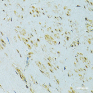 Immunohistochemistry of paraffin-embedded Human uterus using XBP1 Polyclonal Antibody at dilution of 1:100 (40x lens) .