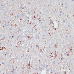 Immunohistochemistry of paraffin-embedded Rat brain using GFAP Polyclonal Antibody at dilution of 1:200 (40x lens) .