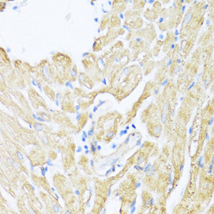 Immunohistochemistry of paraffin-embedded Rat heart using ALOX12 Polyclonal Antibody at dilution of 1:100 (40x lens) .