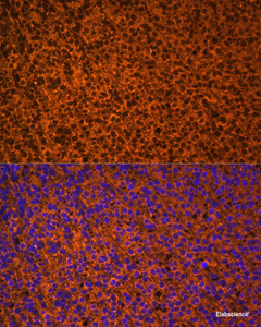 Immunofluorescence analysis of Mouse embryos cells using PTCH1 Polyclonal Antibody at dilution of 1:100. Blue: DAPI for nuclear staining.