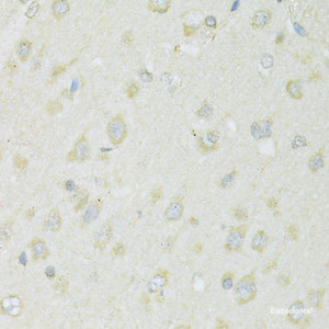 Immunohistochemistry of paraffin-embedded Rat brain using SLC22A5 Polyclonal Antibody at dilution of 1:100 (40x lens) .