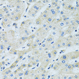 Immunohistochemistry of paraffin-embedded Human liver using SLC5A6 Polyclonal Antibody at dilution of 1:100 (40x lens) .