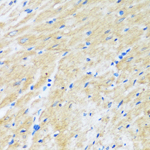 Immunohistochemistry of paraffin-embedded Rat heart using BAG3 Polyclonal Antibody at dilution of 1:100 (40x lens) .