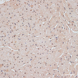Immunohistochemistry of paraffin-embedded Rat heart using TLK1 Polyclonal Antibody at dilution of 1:100 (40x lens) .