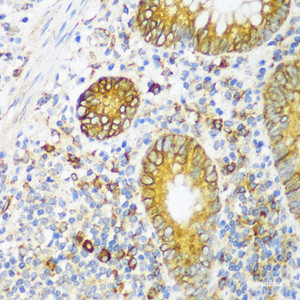 Immunohistochemistry of paraffin-embedded Human appendix using ERLIN1 Polyclonal Antibody at dilution of 1:100 (40x lens) .