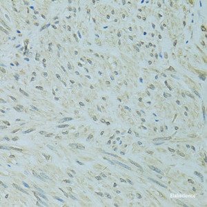 Immunohistochemistry of paraffin-embedded Human uterus using XBP1 Polyclonal Antibody at dilution of 1:100 (40x lens) .