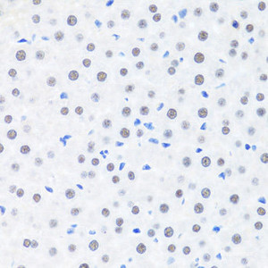 Immunohistochemistry of paraffin-embedded Rat liver using BRMS1 Polyclonal Antibody at dilution of 1:100 (40x lens) .