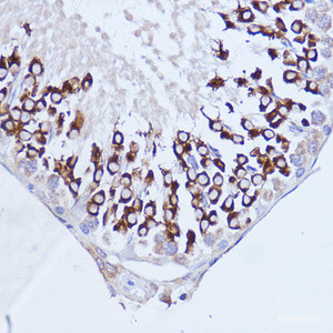 Immunohistochemistry of paraffin-embedded Rat testis using Polyclonal AntibodyPC1 Polyclonal Antibody at dilution of 1:100 (40x lens) .