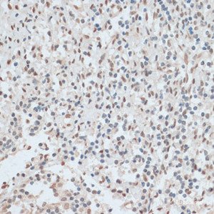 Immunohistochemistry of paraffin-embedded Human tonsil using ZNF574 Polyclonal Antibody at dilution of 1:100 (40x lens) .