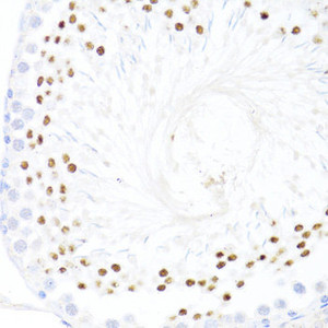 Immunohistochemistry of paraffin-embedded Rat testis using DDX59 Polyclonal Antibody at dilution of 1:100 (40x lens) .