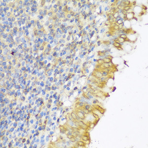 Immunohistochemistry of paraffin-embedded Human appendix using GLB1L3 Polyclonal Antibody at dilution of 1:150 (40x lens) .