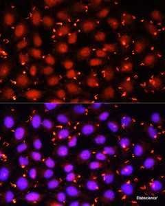 Immunofluorescence analysis of HeLa cells using ACAA1 Polyclonal Antibody at dilution of 1:100 (40x lens) . Blue: DAPI for nuclear staining.