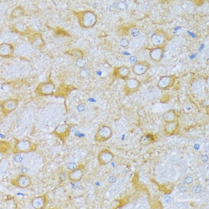 Immunohistochemistry of paraffin-embedded Rat brain using ACADSB Polyclonal Antibody at dilution of 1:100 (40x lens) .
