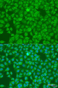 Immunofluorescence analysis of U2OS cells using SLC25A6 Polyclonal Antibody at dilution of 1:100. Blue: DAPI for nuclear staining.