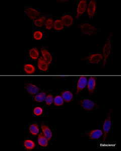 Immunofluorescence analysis of HeLa cells using CYP2A6 Polyclonal Antibody at dilution of 1:100 (40x lens) . Blue: DAPI for nuclear staining.