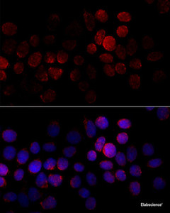 Immunofluorescence analysis of HeLa cells using CYP2J2 Polyclonal Antibody at dilution of 1:100 (40x lens) . Blue: DAPI for nuclear staining.