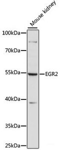 Western blot analysis of extracts of Mouse kidney using EGR2 Polyclonal Antibody at dilution of 1:1000.