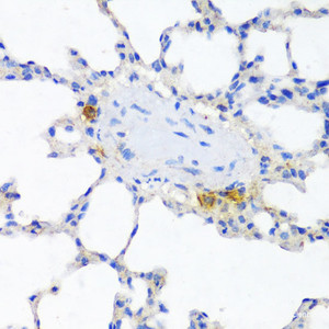 Immunohistochemistry of paraffin-embedded Rat lung using ITGAX Polyclonal Antibody at dilution of 1:100 (40x lens) .