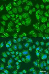 Immunofluorescence analysis of U2OS cells using PFKL Polyclonal Antibody at dilution of 1:100. Blue: DAPI for nuclear staining.
