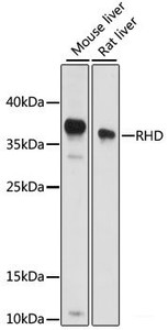 Western blot analysis of extracts of various cell lines using RHD Polyclonal Antibody at dilution of 1:1000.