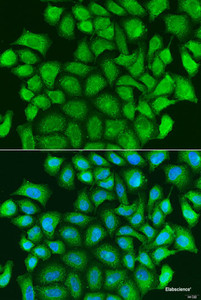 Immunofluorescence analysis of U2OS cells using TRAF3 Polyclonal Antibody at dilution of 1:100. Blue: DAPI for nuclear staining.