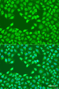 Immunofluorescence analysis of U2OS cells using FZD4 Polyclonal Antibody at dilution of 1:100. Blue: DAPI for nuclear staining.