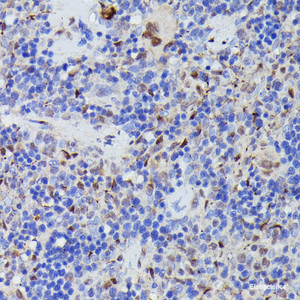 Immunohistochemistry of paraffin-embedded Rat spleen using CDC23 Polyclonal Antibody at dilution of 1:100 (40x lens) .