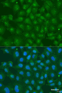 Immunofluorescence analysis of U2OS cells using ZBTB20 Polyclonal Antibody at dilution of 1:100. Blue: DAPI for nuclear staining.