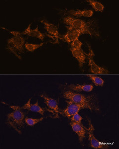 Immunofluorescence analysis of C6 cells using PYCR2 Polyclonal Antibody at dilution of 1:100. Blue: DAPI for nuclear staining.