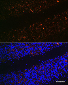 Immunofluorescence analysis of Rat brain using SLC17A6 Polyclonal Antibody at dilution of 1:100 (40x lens) . Blue: DAPI for nuclear staining.