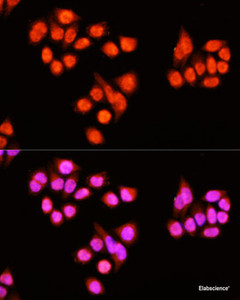 Immunofluorescence analysis of Hela cells using ZNF408 Polyclonal Antibody at dilution of 1:100 (40x lens) . Blue: DAPI for nuclear staining.