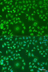 Immunofluorescence analysis of U2OS cells using ARL6 Polyclonal Antibody at dilution of 1:100. Blue: DAPI for nuclear staining.