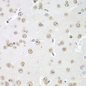 Immunohistochemistry of paraffin-embedded Rat brain using PRMT5 Polyclonal Antibody at dilution of 1:100 (40x lens) .