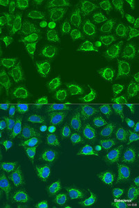 Immunofluorescence analysis of U2OS cells using ALG2 Polyclonal Antibody at dilution of 1:100. Blue: DAPI for nuclear staining.