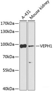 Western blot analysis of extracts of various cell lines using VEPH1 Polyclonal Antibody at dilution of 1:1000.