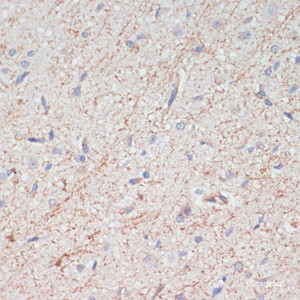 Immunohistochemistry of paraffin-embedded Rat brain using SLC6A3 Polyclonal Antibody at dilution of 1:200 (40x lens) .