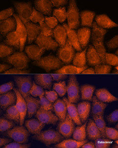 Immunofluorescence analysis of HeLa cells using RPAP3 Polyclonal Antibody at dilution of 1:100. Blue: DAPI for nuclear staining.