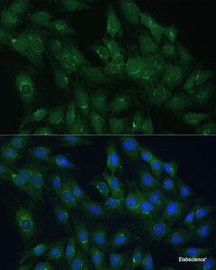 Immunofluorescence analysis of C6 cells using ARL1 Polyclonal Antibody at dilution of 1:100 (40x lens) . Blue: DAPI for nuclear staining.